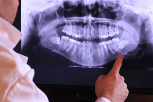 Best Broken or Cracked Tooth Emergency Dentist in Kean University, NJ